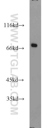 CADM4 Antibody in Western Blot (WB)