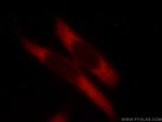TMEM127 Antibody in Immunocytochemistry (ICC/IF)