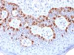 MART-1/Melan-A/MLANA Recombinant Mouse Monoclonal Antibody (rMLANA, 788)