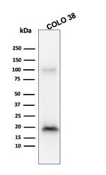 MART-1/Melan-A/MLANA (Melanoma Marker) Antibody in Western Blot (WB)
