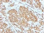 MART-1/Melan-A/MLANA (Melanoma Marker) Monoclonal Antibody (SPM555)