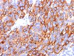 MART-1/Melan-A/MLANA (Melanoma Marker) Monoclonal Antibody (A103, M2-7C10, M2-9E3)