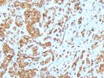 MART-1/Melan-A/MLANA (Melanoma Marker) Monoclonal Antibody (MLANA/788)
