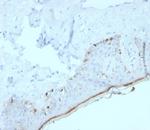 MART-1/Melan-A/MLANA (Melanoma Marker) Recombinant Rabbit Monoclonal Antibody (MLANA/4385R)