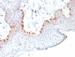 MART-1/Melan-A/MLANA (Melanoma Marker) Recombinant Rabbit Monoclonal Antibody (MLANA/8108R)