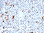MART-1/Melan-A/MLANA (Melanoma Marker) Recombinant Rabbit Monoclonal Antibody (MLANA/8365R)