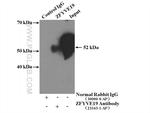 ZFYVE19 Antibody in Immunoprecipitation (IP)
