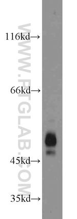 ZFYVE19 Antibody in Western Blot (WB)