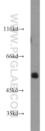 ZSCAN21 Antibody in Western Blot (WB)