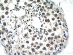 ATXN3L Antibody in Immunohistochemistry (Paraffin) (IHC (P))