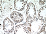 ATXN3L Antibody in Immunohistochemistry (Paraffin) (IHC (P))
