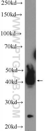 ATXN3L Antibody in Western Blot (WB)