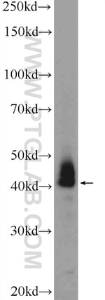 ATXN3L Antibody in Western Blot (WB)