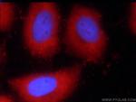C9orf11 Antibody in Immunocytochemistry (ICC/IF)