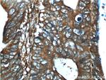 RHBDF2 Antibody in Immunohistochemistry (Paraffin) (IHC (P))