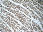 MMADHC Antibody in Immunohistochemistry (Paraffin) (IHC (P))