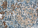 MMADHC Antibody in Immunohistochemistry (Paraffin) (IHC (P))