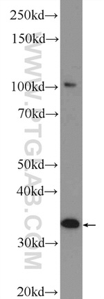 MMADHC Antibody in Western Blot (WB)