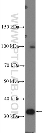 MMADHC Antibody in Western Blot (WB)