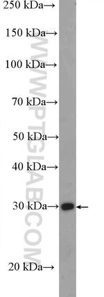 MMADHC Antibody in Western Blot (WB)