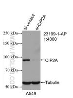 CIP2A Antibody in Western Blot (WB)