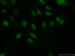 EVI1 Antibody in Immunocytochemistry (ICC/IF)