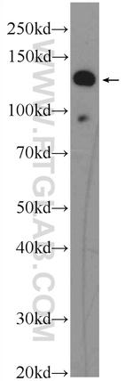 EVI1 Antibody in Western Blot (WB)