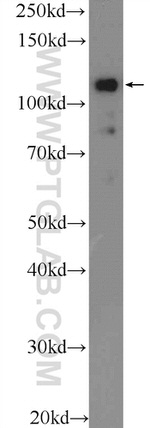 EVI1 Antibody in Western Blot (WB)