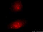 Claspin Antibody in Immunocytochemistry (ICC/IF)