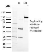 VEGF-R1/FLT-1 Monoclonal Antibody (FLT1, 658)