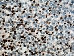 DLX6 Antibody in Immunohistochemistry (Paraffin) (IHC (P))