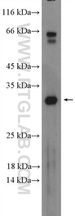 DLX6 Antibody in Western Blot (WB)