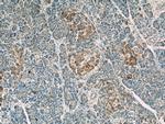 LRRC47 Antibody in Immunohistochemistry (Paraffin) (IHC (P))