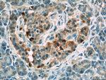 LRRC47 Antibody in Immunohistochemistry (Paraffin) (IHC (P))