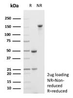 Flt3/CD135 Antibody in SDS-PAGE (SDS-PAGE)