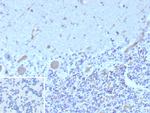 Flt3/CD135 Monoclonal Antibody (FLT3/9884)