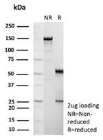 Flt3/CD135 Antibody in SDS-PAGE (SDS-PAGE)