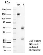 Flt3/CD135 Antibody in SDS-PAGE (SDS-PAGE)