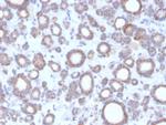 DBC2/RHOBTB2 Antibody in Immunohistochemistry (Paraffin) (IHC (P))