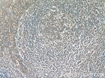 ATG2A Antibody in Immunohistochemistry (Paraffin) (IHC (P))