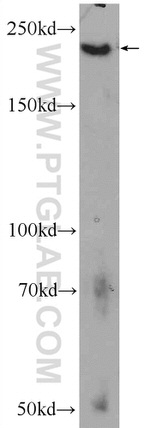 ATG2A Antibody in Western Blot (WB)