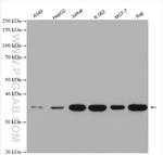MYD88 Antibody in Western Blot (WB)