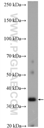 MYD88 Antibody in Western Blot (WB)