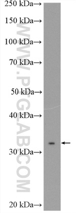 MYD88 Antibody in Western Blot (WB)