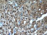 TBX18 Antibody in Immunohistochemistry (Paraffin) (IHC (P))