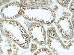 ZNF311 Antibody in Immunohistochemistry (Paraffin) (IHC (P))