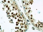ZNF311 Antibody in Immunohistochemistry (Paraffin) (IHC (P))