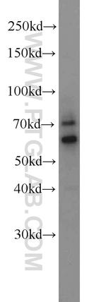 ZNF311 Antibody in Western Blot (WB)