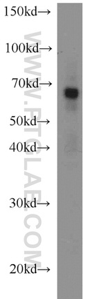 ZNF311 Antibody in Western Blot (WB)