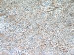 IFIT1 Antibody in Immunohistochemistry (Paraffin) (IHC (P))